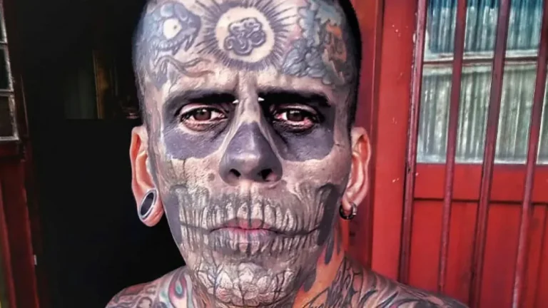 “Looked Better With Them”: 95% Tattooed Man Reveals Shocking Look After Laser Removal